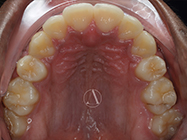 After - Ali Orthodontics Dental