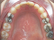 After - Ali Orthodontics Dental