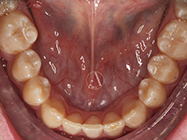 After - Ali Orthodontics Dental