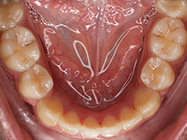 After - Ali Orthodontics Dental