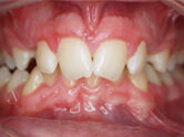 Before - Ali Orthodontics Dental