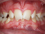 Before - Ali Orthodontics Dental