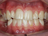 Before - Ali Orthodontics Dental