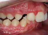 Before - Ali Orthodontics Dental