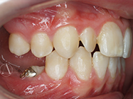 Before - Ali Orthodontics Dental