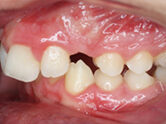 Before - Ali Orthodontics Dental