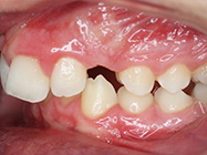 Before - Ali Orthodontics Dental