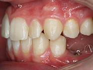 Before - Ali Orthodontics Dental