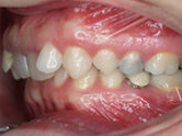 Before - Ali Orthodontics Dental