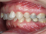 Before - Ali Orthodontics Dental