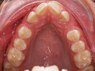 Before - Ali Orthodontics Dental