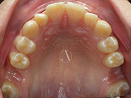 Before - Ali Orthodontics Dental