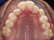 Before - Ali Orthodontics Dental