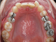 Before - Ali Orthodontics Dental