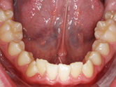 Before - Ali Orthodontics Dental