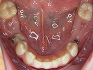 Before - Ali Orthodontics Dental