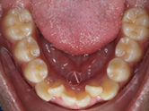 Before - Ali Orthodontics Dental
