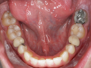 Before - Ali Orthodontics Dental