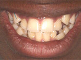 Before - Ali Orthodontics Dental