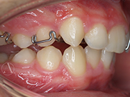 After - Ali Orthodontics Dental