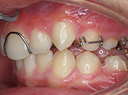 After - Ali Orthodontics Dental