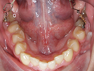 After - Ali Orthodontics Dental