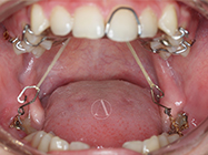 After - Ali Orthodontics Dental