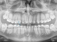 After - Ali Orthodontics Dental