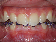 After - Ali Orthodontics Dental