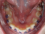 After - Ali Orthodontics Dental