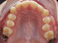 After - Ali Orthodontics Dental