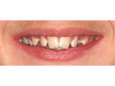 Before - Ali Orthodontics Dental