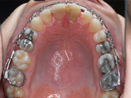 After - Ali Orthodontics Dental