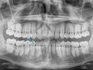 After - Ali Orthodontics Dental