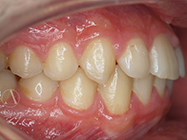 After - Ali Orthodontics Dental