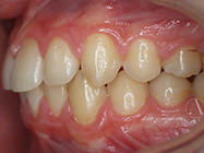 After - Ali Orthodontics Dental