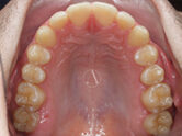 After - Ali Orthodontics Dental
