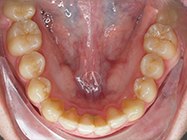 After - Ali Orthodontics Dental