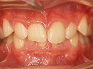 Before - Ali Orthodontics Dental