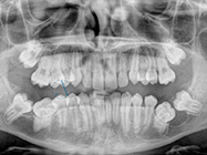 Before - Ali Orthodontics Dental