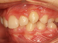 Before - Ali Orthodontics Dental