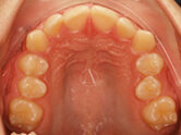 Before - Ali Orthodontics Dental