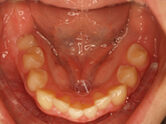 Before - Ali Orthodontics Dental