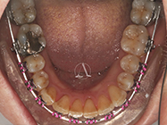 After - Ali Orthodontics Dental