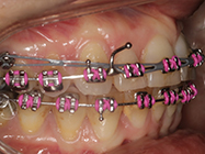 After - Ali Orthodontics Dental