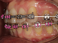 After - Ali Orthodontics Dental