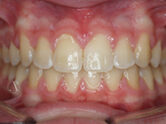After - Ali Orthodontics Dental
