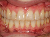 After - Ali Orthodontics Dental