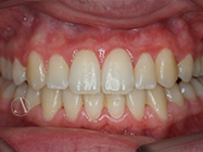 After - Ali Orthodontics Dental
