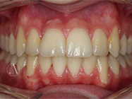 After - Ali Orthodontics Dental
